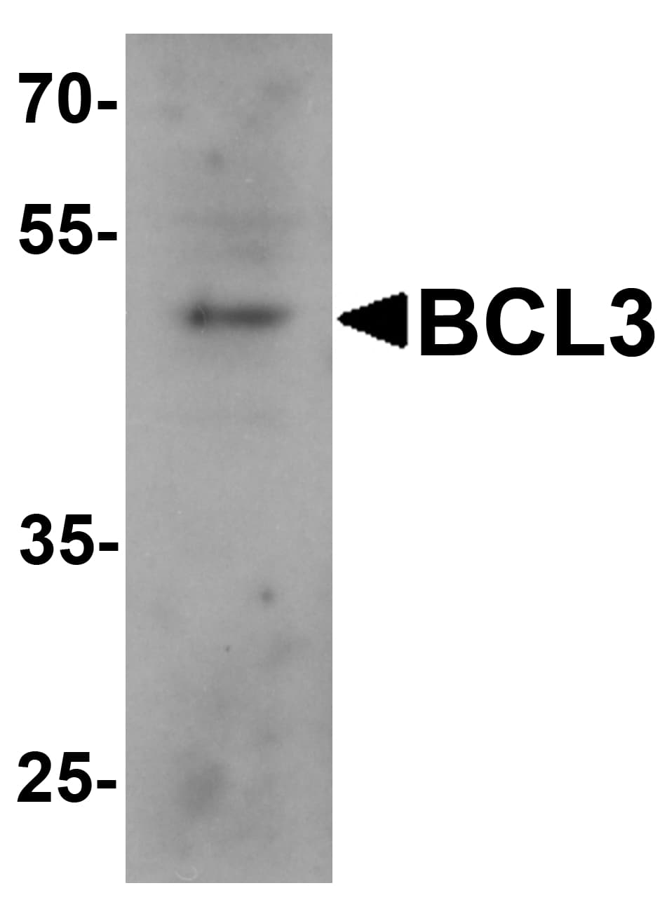 IHC-plus™ BCL3 / BCL-3 Antibody