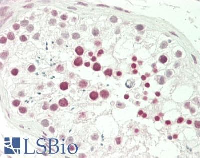 Polyclonal Rabbit anti-Human RFX4 Antibody (aa22-71, IHC, WB)