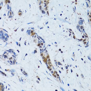TOPBP1 Antibody