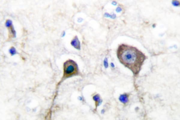 S100A1 / S100-A1 Antibody (Ala18)