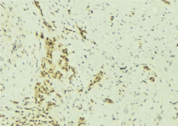Polyclonal Rabbit anti-Human SMARCA5 / SNF2H Antibody (IHC, WB)