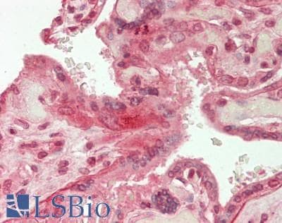 IHC-plus™ Polyclonal Rabbit anti-Human LAMA5 / Laminin Alpha 5 Antibody (aa2371-2420, IHC, WB)