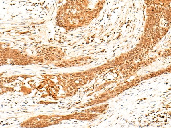 Polyclonal Rabbit anti-Human HNF4A / HNF4 Antibody (IHC)