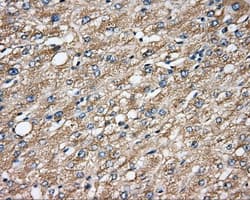 CAPZA1 / CAPZ Alpha 1 Antibody (clone OTI2G4)