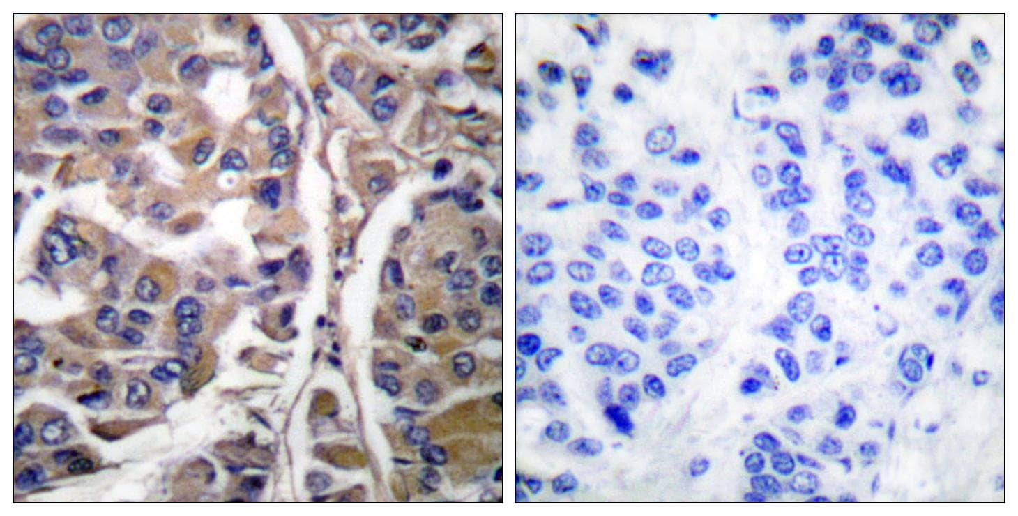 KRT20 / CK20 / Cytokeratin 20 Antibody