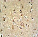 BOD1 Antibody (aa127-155)