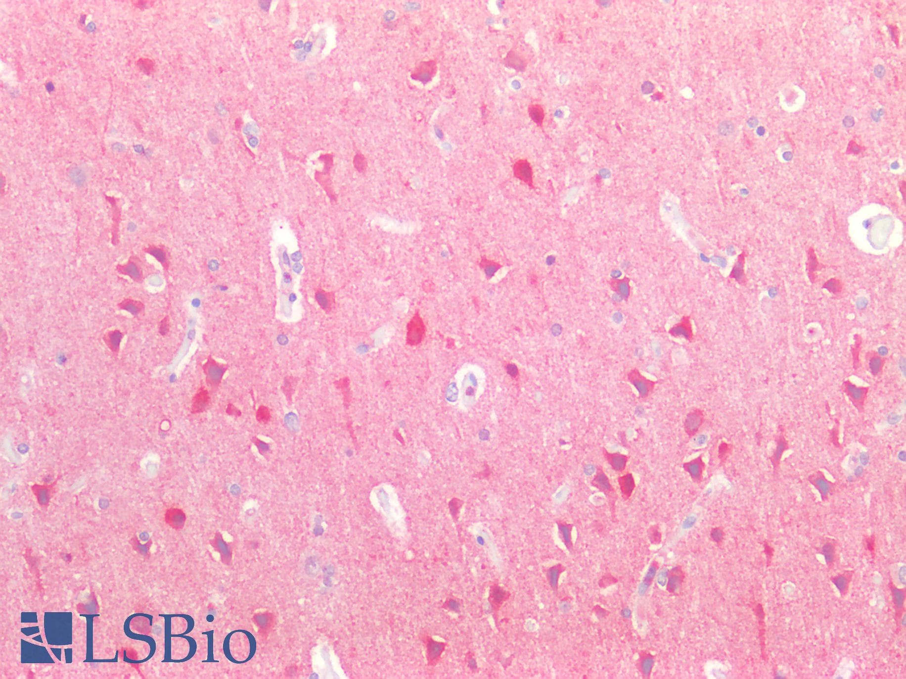 Ubiquilin 2 / UBQLN2 Antibody (aa33-126)