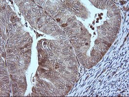 MAP2K1 / MKK1 / MEK1 Antibody (clone OTI4B1)