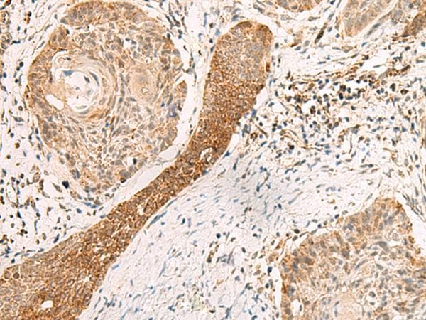 Polyclonal Rabbit anti-Human EXD2 Antibody (IHC, WB)