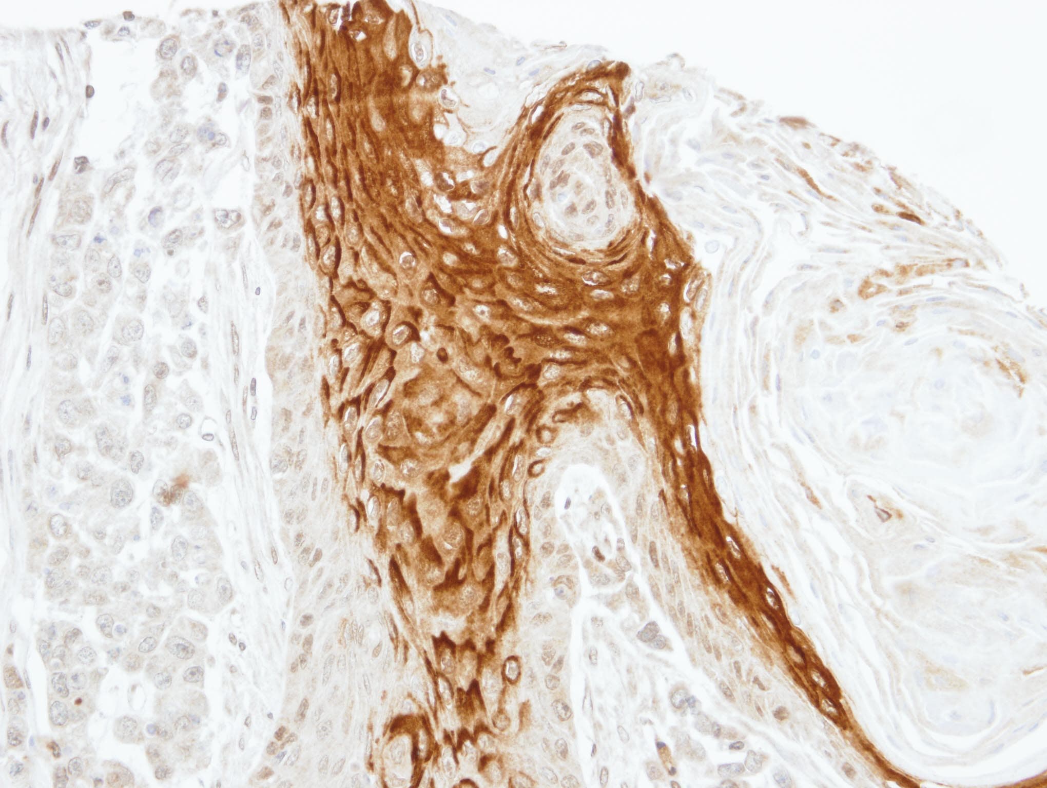 RAMP2 Antibody (aa111-175)