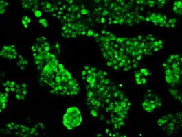 RPA2 / RFA2 / RPA34 Antibody (clone OTI8B3)