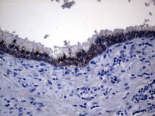 Monoclonal Mouse anti-Human ROR2 Antibody (clone OTI3H3, aa796-927, IHC, WB)
