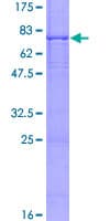 Human BBS1 Protein (Recombinant GST)