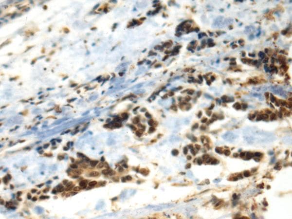 DDX39 Antibody