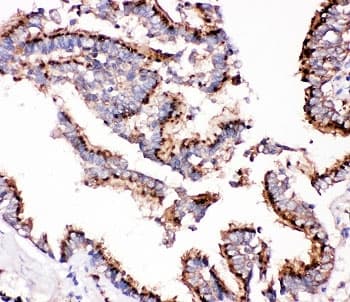 CTSD / Cathepsin D Antibody (aa65-412)