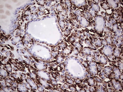 Vimentin Antibody (clone UMAB160, Carrier-free)