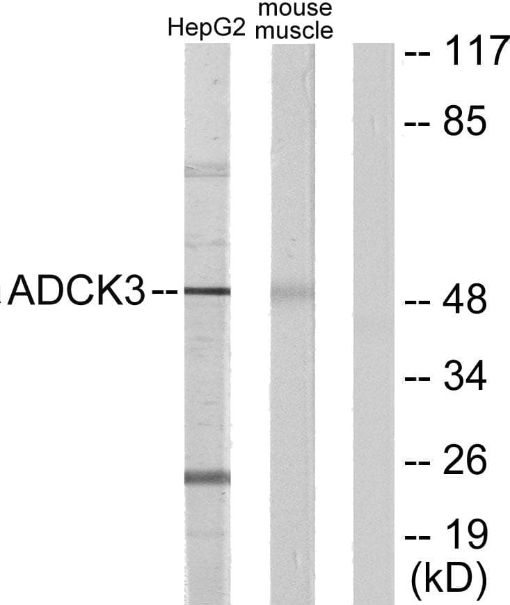 ADCK3 / CABC1 Antibody