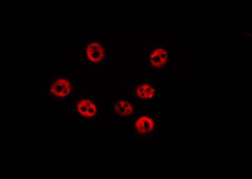 RPS6KA1 / RSK1 Antibody (phospho-Thr359,pSer363)