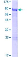 Human SPATC1 Protein (Recombinant GST)