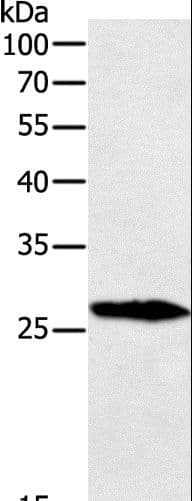Polyclonal Rabbit anti-Human GREM1 / Gremlin-1 Antibody (WB)