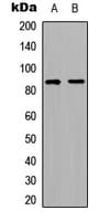 RFWD3 Antibody (Internal)