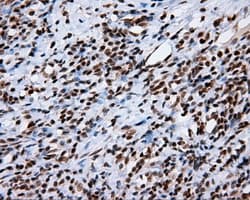 TLDC1 / KIAA1609 Antibody (clone OTI12B1)