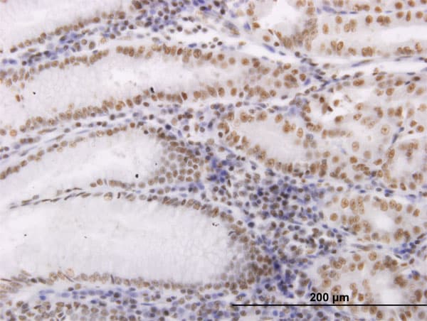 Monoclonal Mouse anti-Human OXSR1 / OSR1 Antibody (clone 6C7, IHC, IF, WB)
