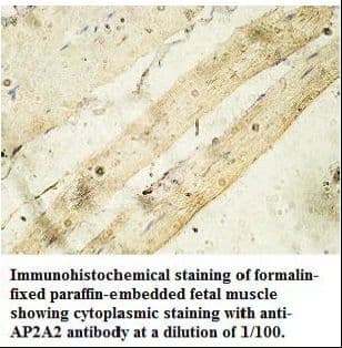 AP2B1 Antibody (aa737-950)