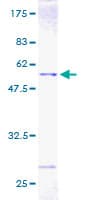 Human EIF4E Protein (Recombinant GST)
