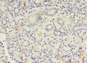 MTRR Antibody (aa1-725)