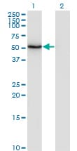 ZSCAN21 / Zipro1 Antibody (clone 4B11)