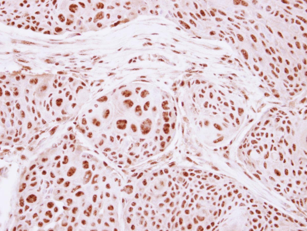 GTF3C4 Antibody