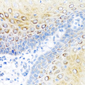 S100A7 / Psoriasin Antibody