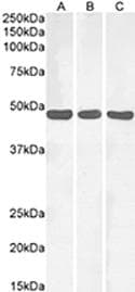Polyclonal Rabbit anti-Mouse NPY1R Antibody (WB)