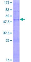 Human CLDN18 / Claudin 18 Protein (Recombinant GST)