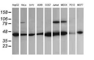 IHC-plus™ ACAA2 Antibody (clone 1C10)