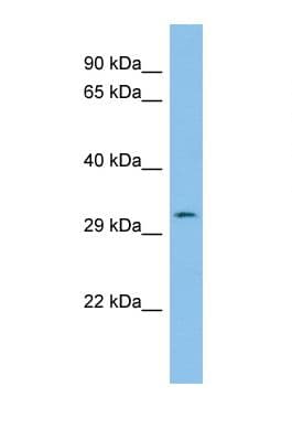 PTHR / PTHR1 Antibody (N-Terminus)