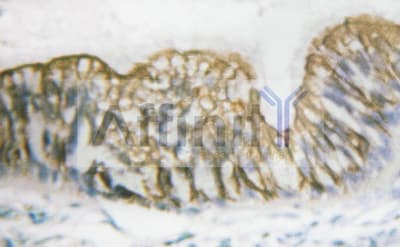 PDGFRB / PDGFR Beta Antibody (phospho-Tyr740)