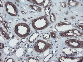 COMMD1 Antibody (clone OTI1F2)