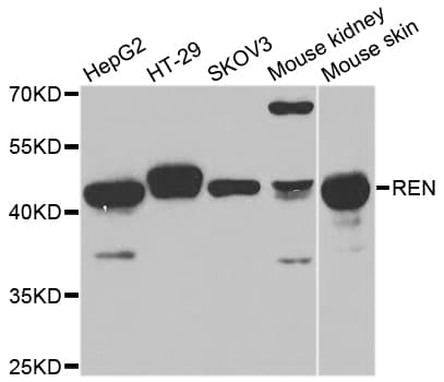 REN / Renin 1 Antibody