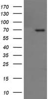 TP73 / p73 Antibody (clone OTI2H5)