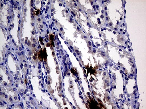 IL24 Antibody (aa52-206, clone OTI3C5)