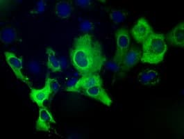 Monoclonal Mouse anti-Human IGF2BP2 Antibody (clone OTI4F7, IF, WB)