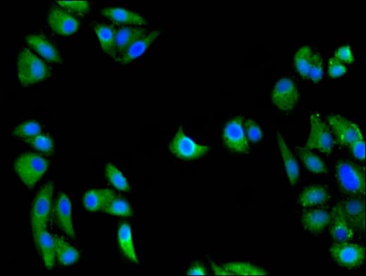 Polyclonal Rabbit anti-Human CED6 / GULP1 Antibody (IF, WB)