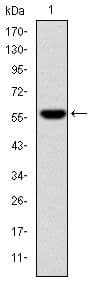 FGG / Fibrinogen Gamma Antibody (clone 4H9)