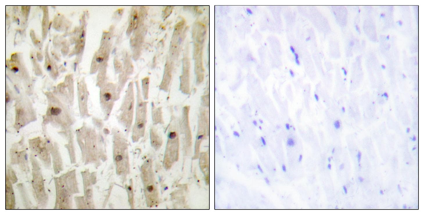Polyclonal Rabbit anti-Human TSHZ1 Antibody (IHC)