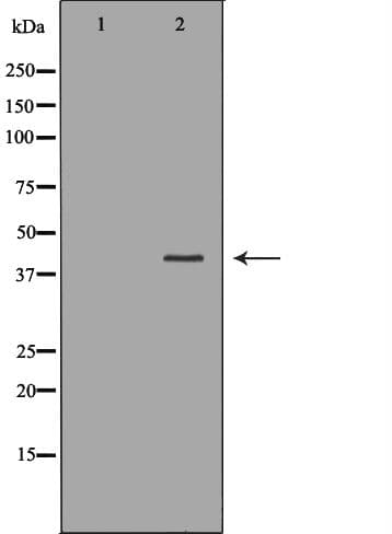 UROD Antibody
