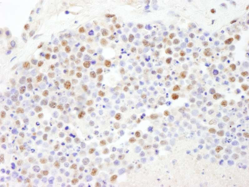 Polyclonal Rabbit anti-Human POLD3 Antibody (aa325-375, IHC)