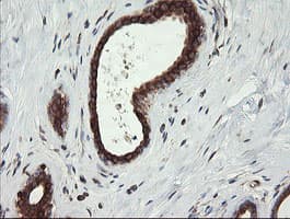 TAPBPL / TAPBPR Antibody (clone OTI4H5)