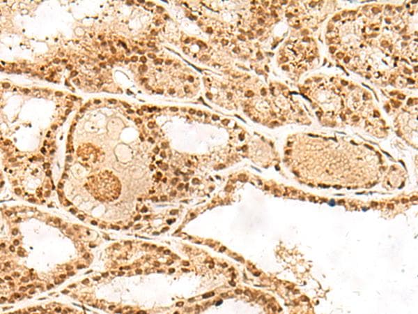 POLH / DNA Polymerase Eta Antibody